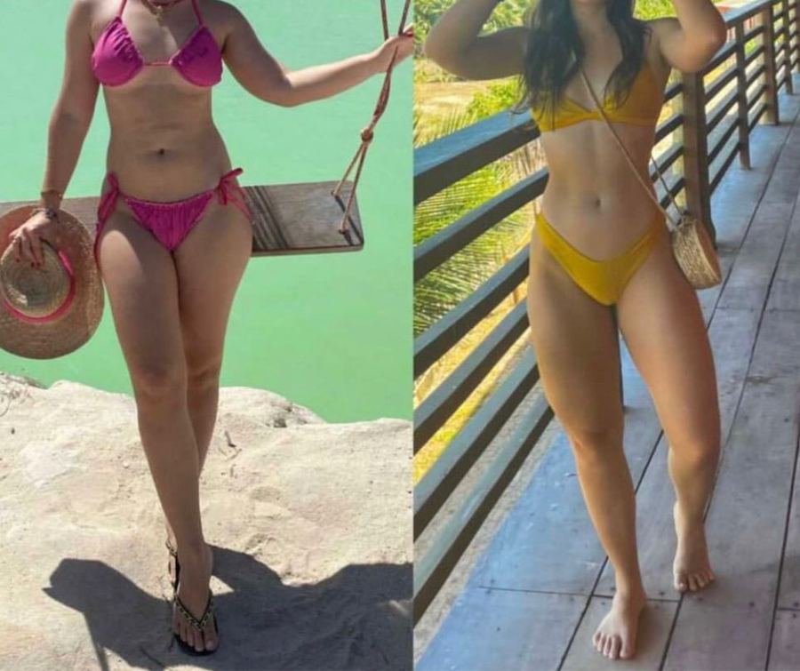 Antes e depois de aluna do protocolo