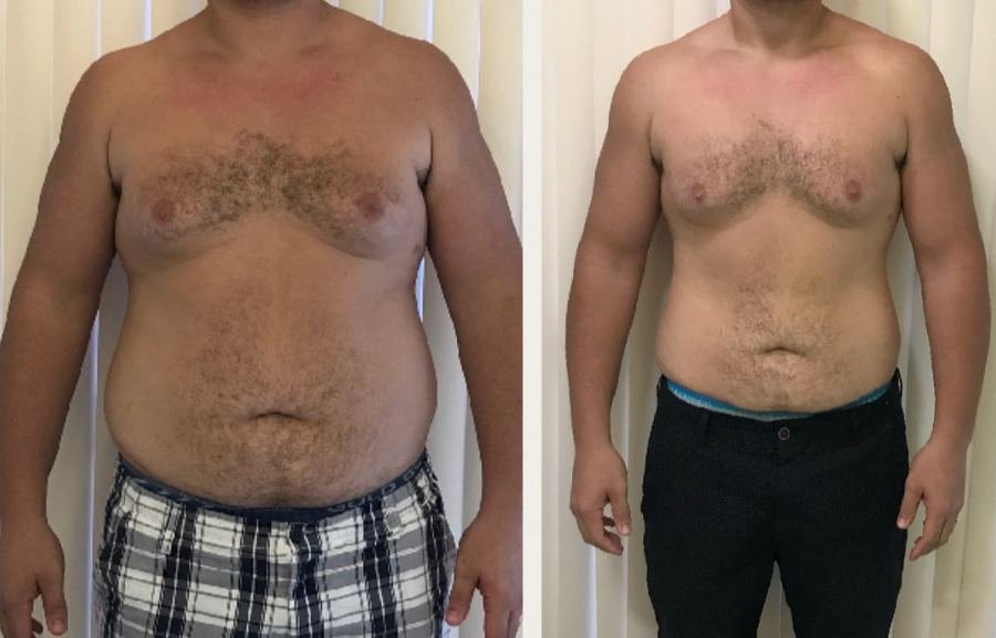 Antes e depois de aluno do protocolo