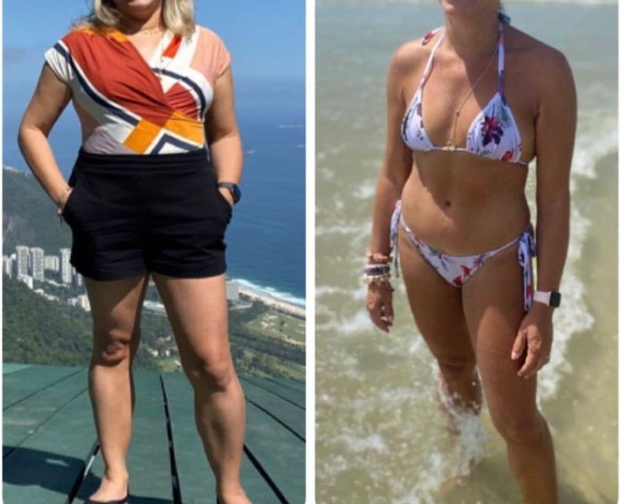Antes e depois de aluna do protocolo